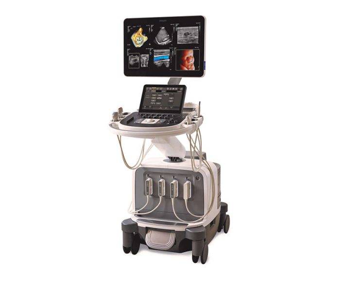 Philips EPIQ Elite Ultrasound System