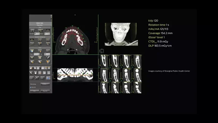 Philips Access CT Scanner - Image 3