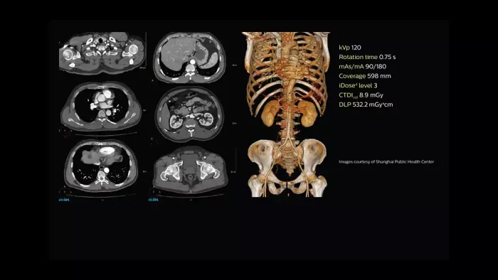 Philips Access CT Scanner - Image 4