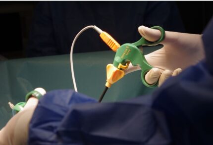 Grena Disposable Endoscopic Instruments (Scissors, Dissectors, Graspers)